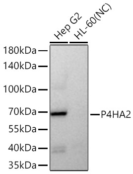 P4HA2 Rabbit Monoclonal Antibody