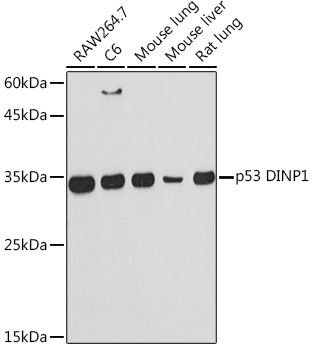 p53 DINP1 Rabbit Monoclonal Antibody - Image 2