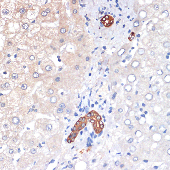 p53 DINP1 Rabbit Monoclonal Antibody - Image 3