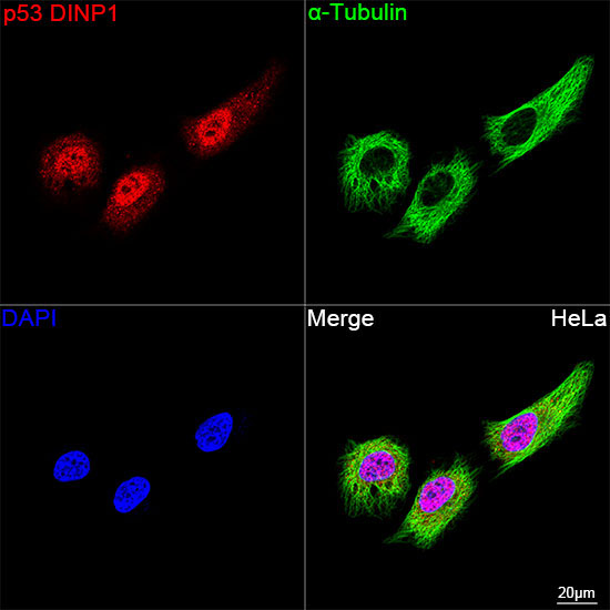 p53 DINP1 Rabbit Monoclonal Antibody - Image 4