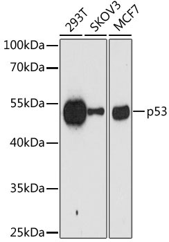 p53 Mouse Monoclonal Antibody