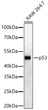 p53 Rabbit Monoclonal Antibody