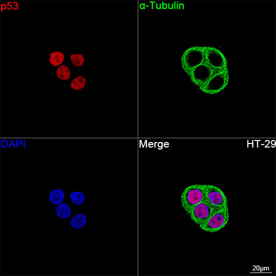 p53 Rabbit Monoclonal Antibody - Image 2