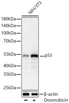 p53 Rabbit Monoclonal Antibody - Image 4