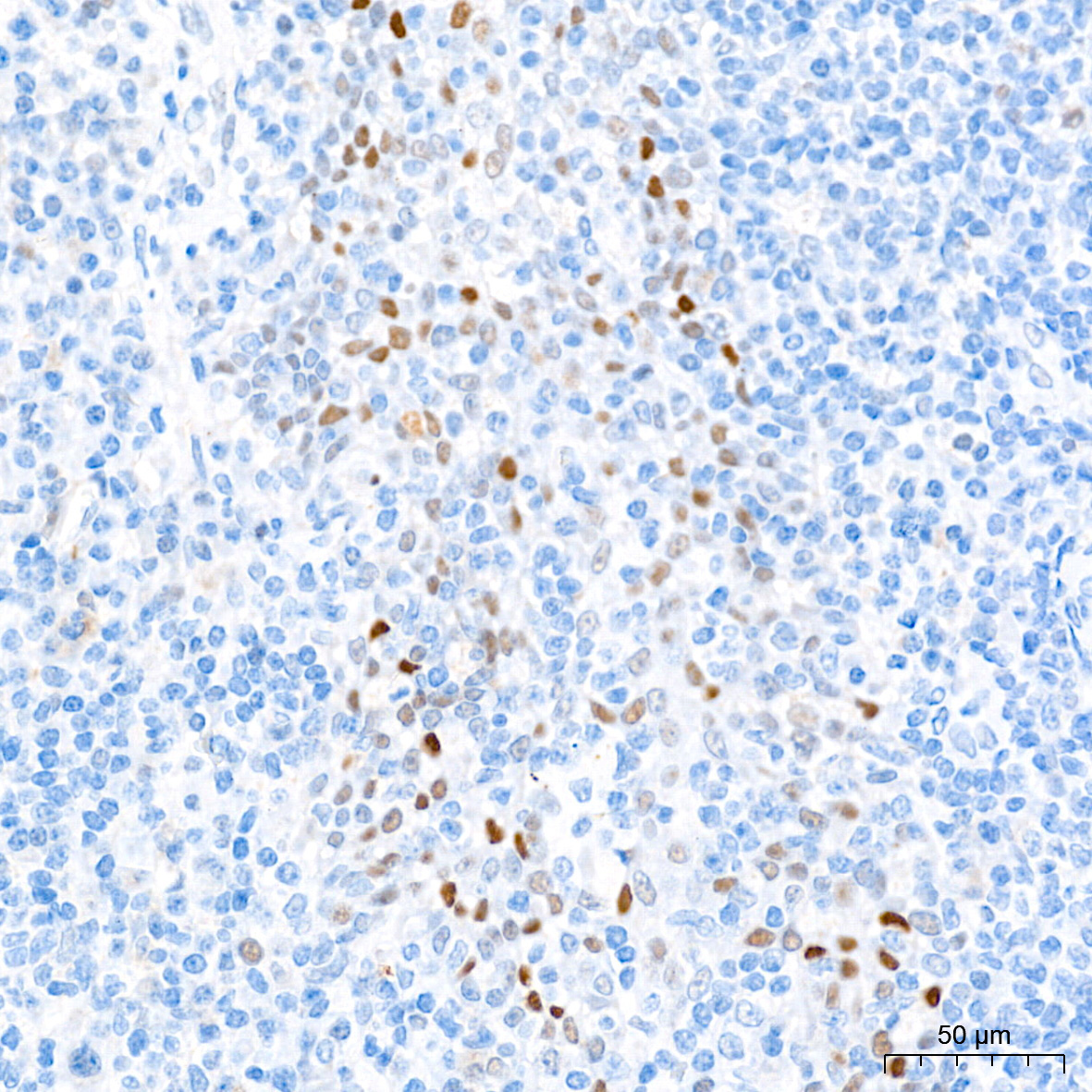 p53 Rabbit Monoclonal Antibody - Image 6