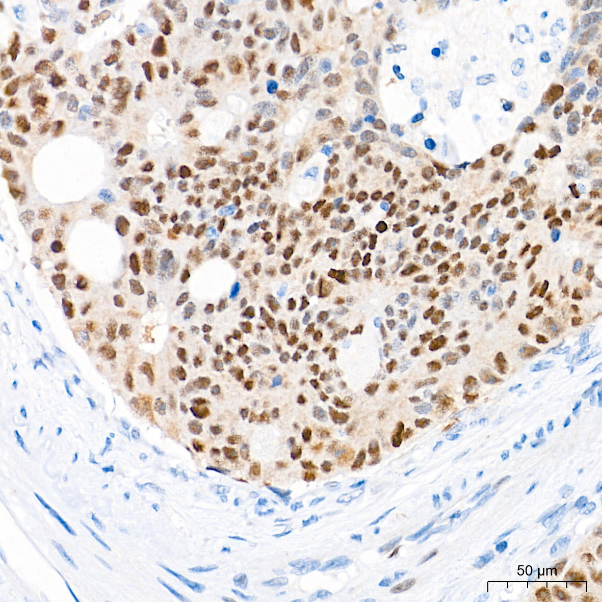 p53 Rabbit Monoclonal Antibody - Image 7
