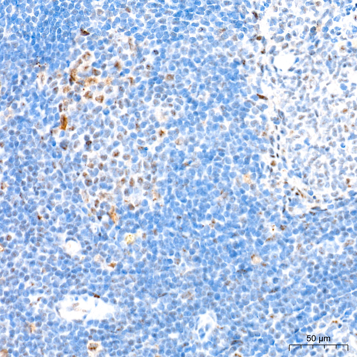 p53 Rabbit Monoclonal Antibody - Image 8