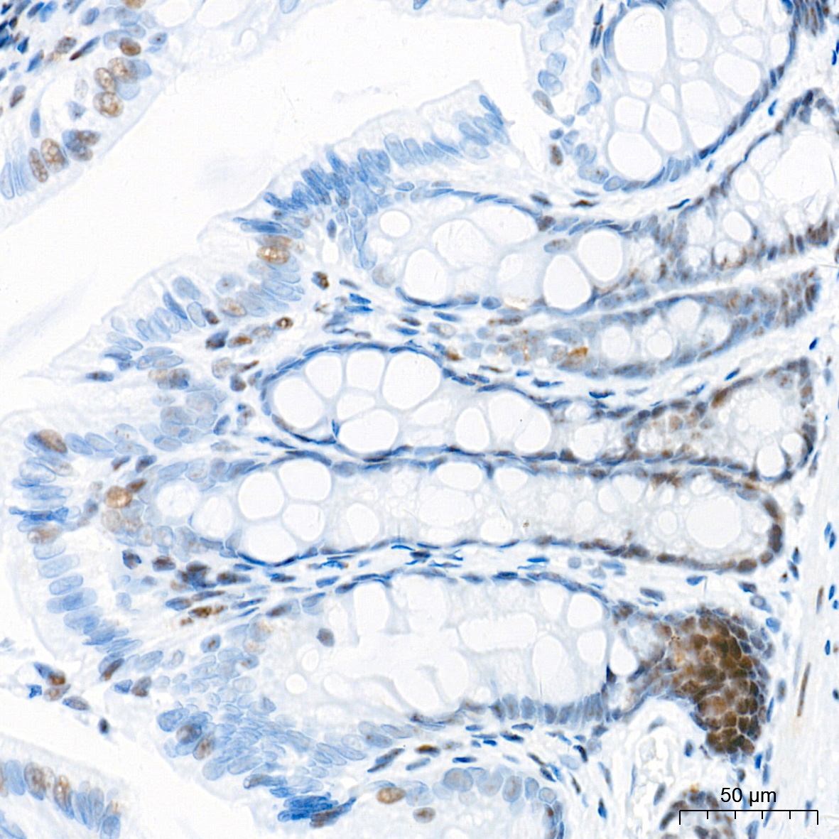 p53 Rabbit Monoclonal Antibody - Image 9