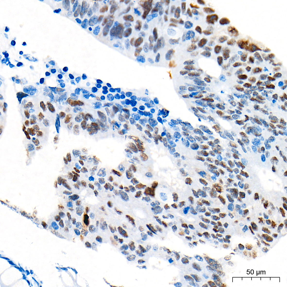 p53 Rabbit Monoclonal Antibody - Image 10