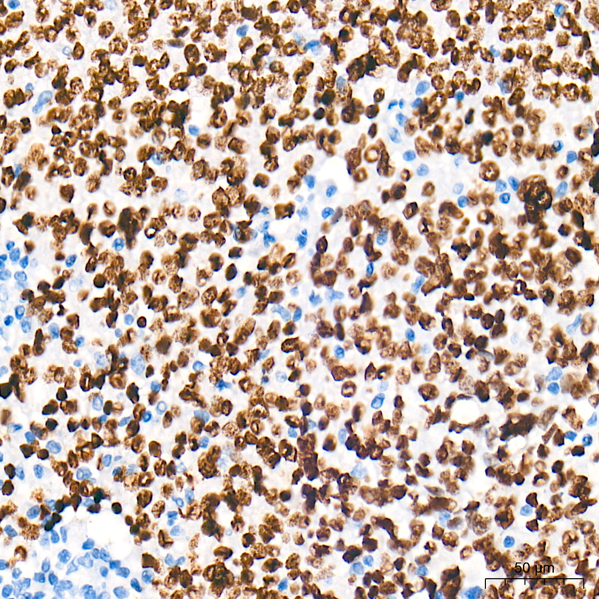 p53 Rabbit Monoclonal Antibody - Image 11