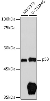 p53 Rabbit Polyclonal Antibody