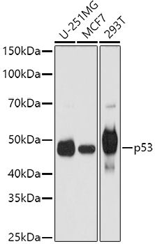 p53 Rabbit Polyclonal Antibody