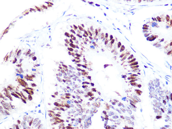 p60 CAF1 Rabbit Monoclonal Antibody - Image 2