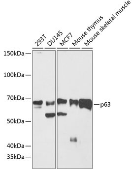p63 Rabbit Monoclonal Antibody