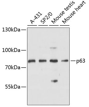 p63 Rabbit Polyclonal Antibody