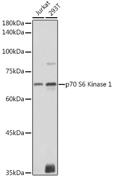p70 S6 Kinase 1 Rabbit Polyclonal Antibody