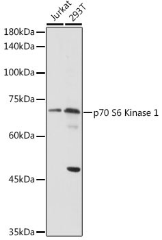 p70 S6 Kinase 1 Rabbit Polyclonal Antibody