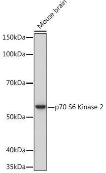 p70 S6 Kinase 2 Rabbit Monoclonal Antibody