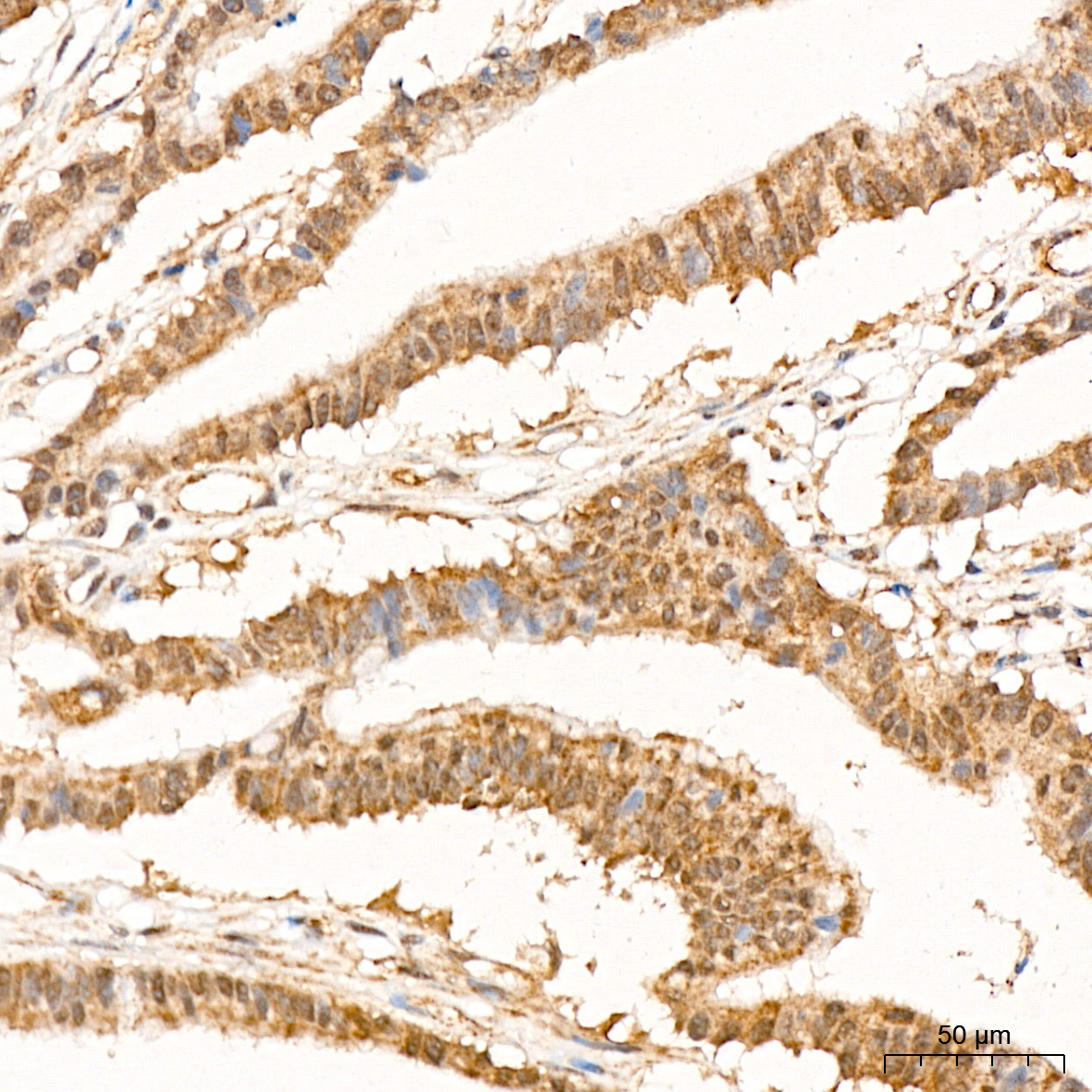 p70 S6 Kinase 2 Rabbit Monoclonal Antibody - Image 3