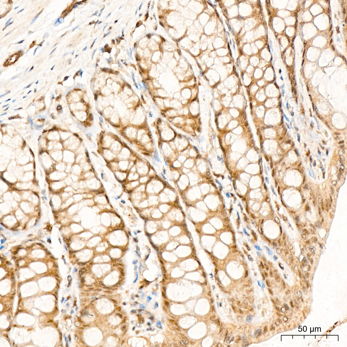 p70 S6 Kinase 2 Rabbit Monoclonal Antibody - Image 4