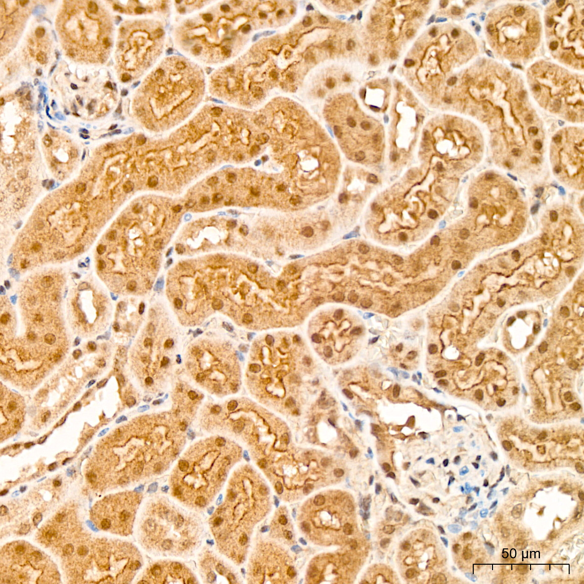 p70 S6 Kinase 2 Rabbit Monoclonal Antibody - Image 5