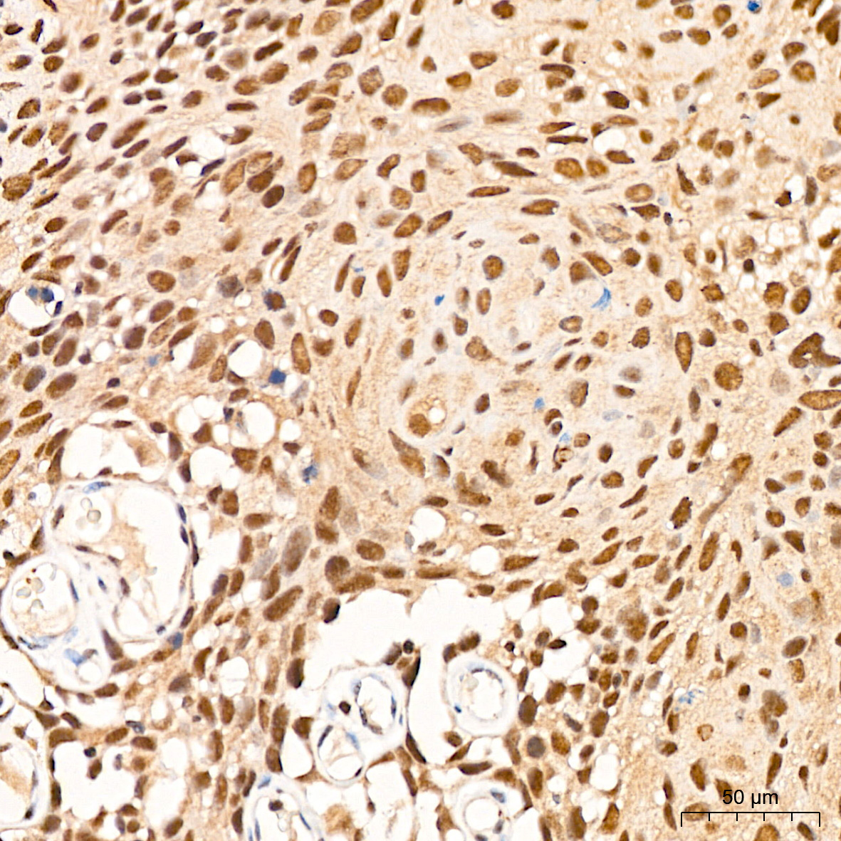 p70 S6 Kinase 2 Rabbit Monoclonal Antibody - Image 6