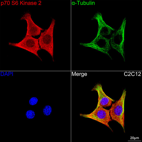 p70 S6 Kinase 2 Rabbit Monoclonal Antibody - Image 7
