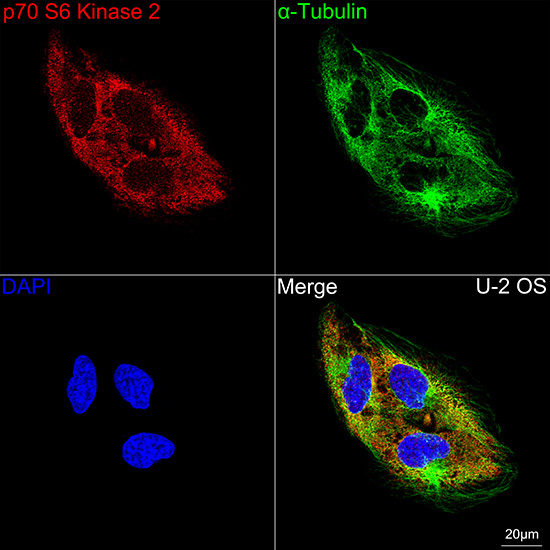 p70 S6 Kinase 2 Rabbit Monoclonal Antibody - Image 9
