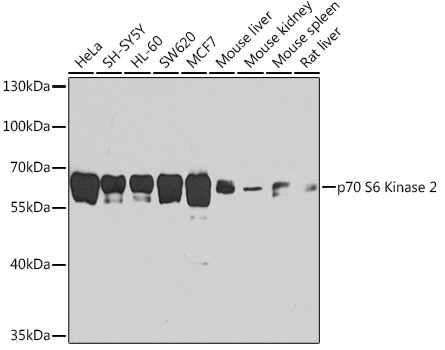 p70 S6 Kinase 2 Rabbit Polyclonal Antibody