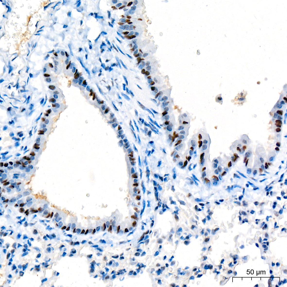 p73 Rabbit Monoclonal Antibody - Image 2