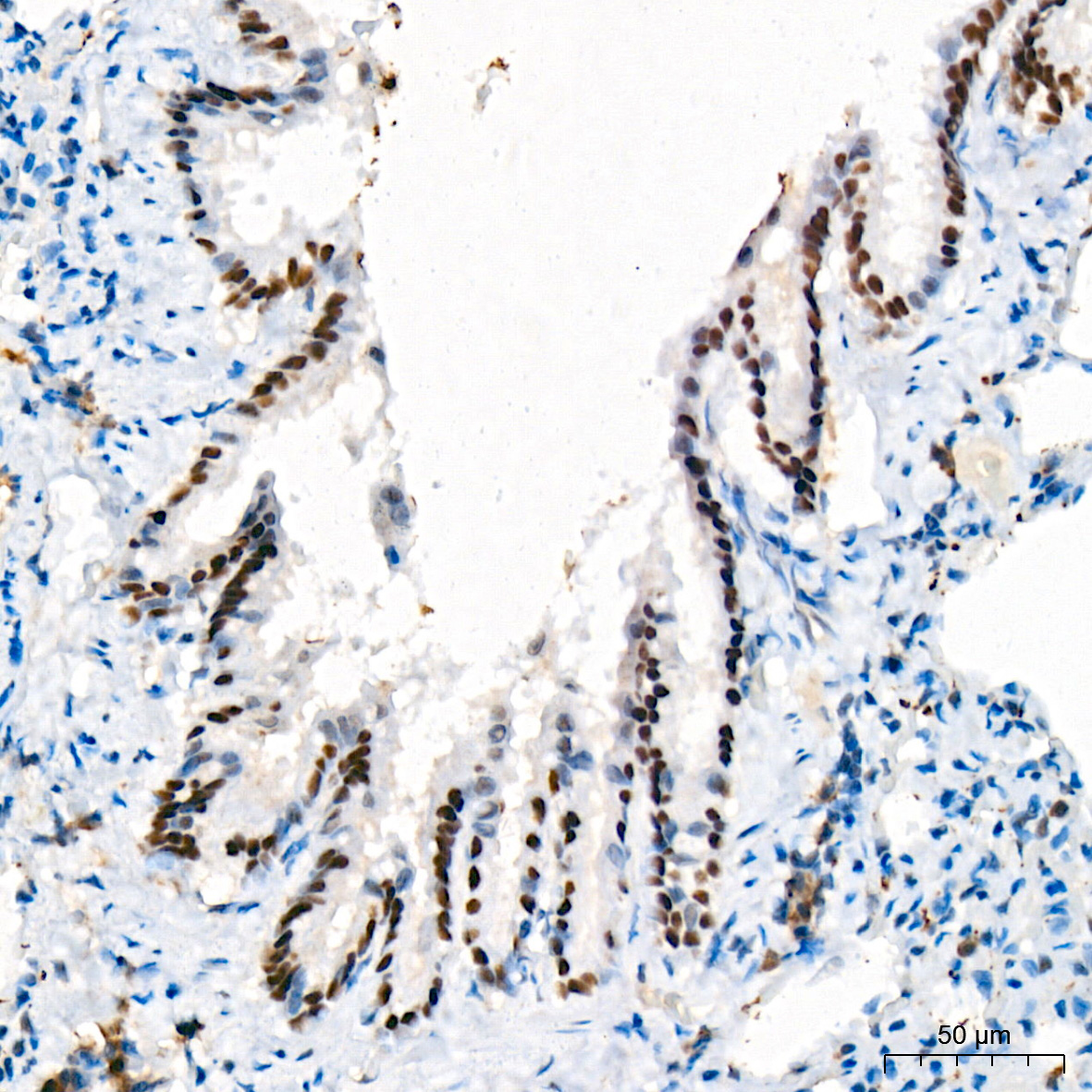 p73 Rabbit Monoclonal Antibody - Image 3