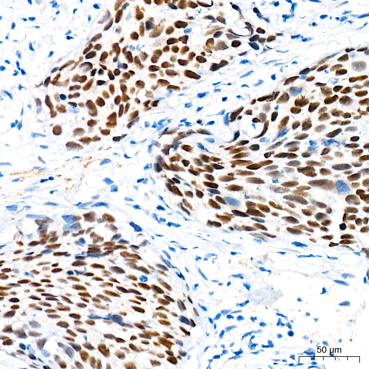 p73 Rabbit Monoclonal Antibody - Image 4