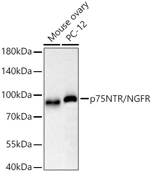 p75NTR/NGFR Rabbit Monoclonal Antibody