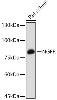 p75NTR/NGFR Rabbit Polyclonal Antibody