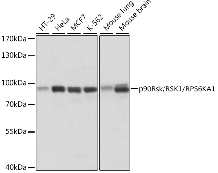 p90Rsk/RSK1/RPS6KA1 Rabbit Polyclonal Antibody