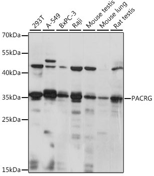 PACRG Rabbit Polyclonal Antibody