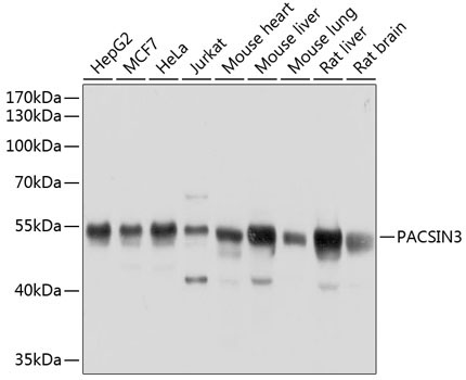 PACSIN3 Rabbit Polyclonal Antibody