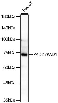 PADI1/PAD1 Rabbit Monoclonal Antibody