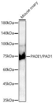 PADI1/PAD1 Rabbit Monoclonal Antibody - Image 2