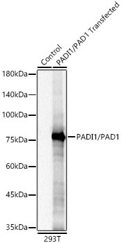 PADI1/PAD1 Rabbit Monoclonal Antibody - Image 3
