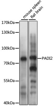 PADI2 Rabbit Polyclonal Antibody
