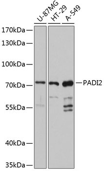 PADI2 Rabbit Polyclonal Antibody