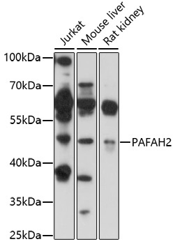 PAFAH2 Rabbit Polyclonal Antibody