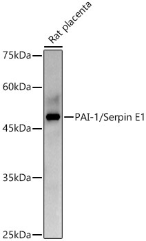 PAI-1/Serpin E1 Rabbit Polyclonal Antibody