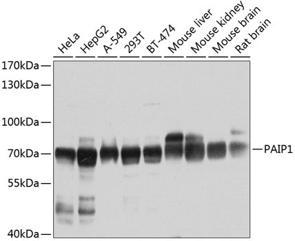 PAIP1 Rabbit Polyclonal Antibody
