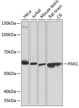 PAK1 Rabbit Monoclonal Antibody