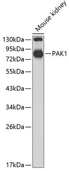 PAK1 Rabbit Polyclonal Antibody