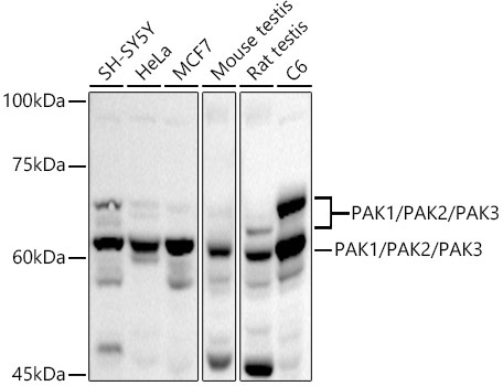 PAK1/PAK2/PAK3 Rabbit Polyclonal Antibody