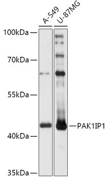 PAK1IP1 Rabbit Polyclonal Antibody