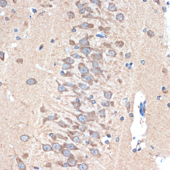 PAK3 Rabbit Monoclonal Antibody - Image 2